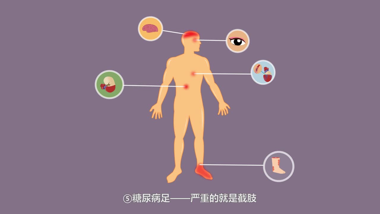 二维MG类样片